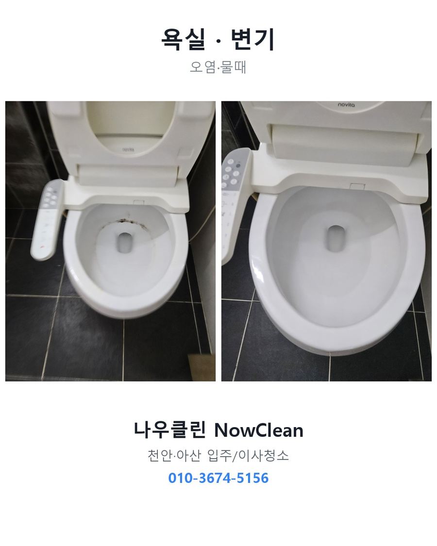 전후 사진